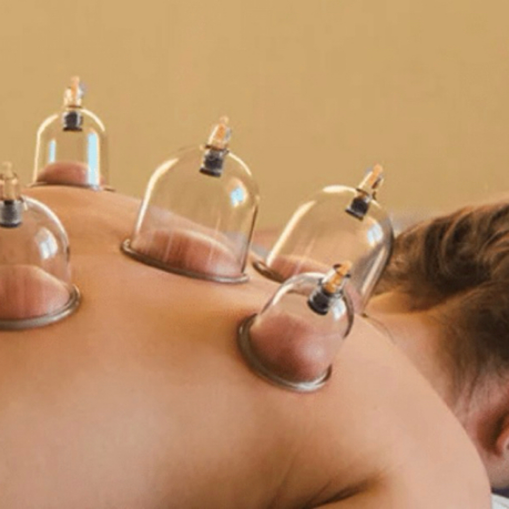 Cupping Therapy at Luminous Aesthetic Spa in Quincy, MA