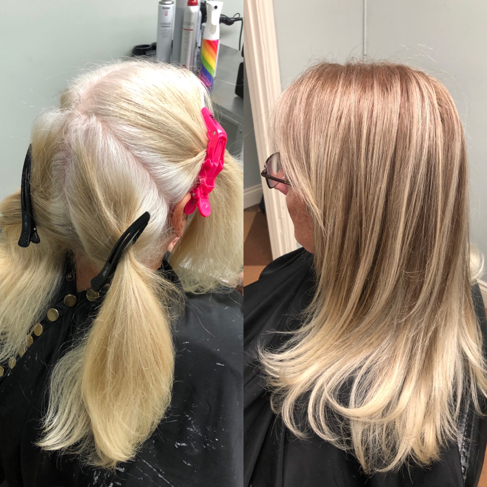 Gray Root Coverage