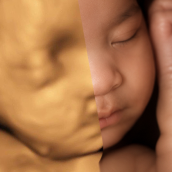 Add-On 8K Rendering at San Bernardino 3D 4D Ultrasound by 4D Special Delivery in San Bernardino, CA