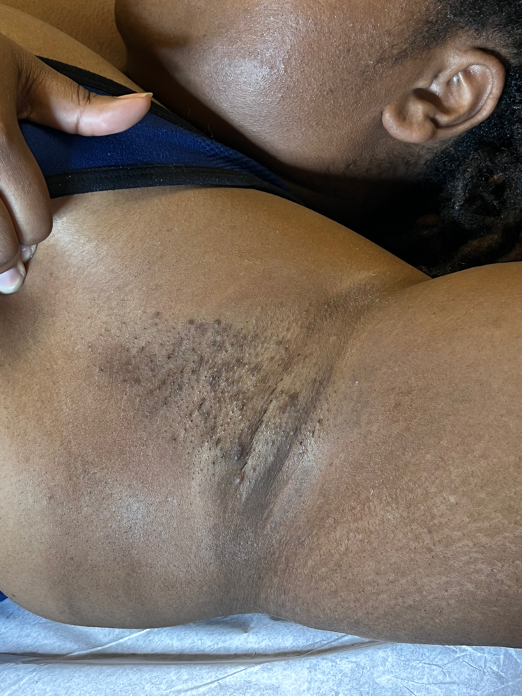 Underarm Wax