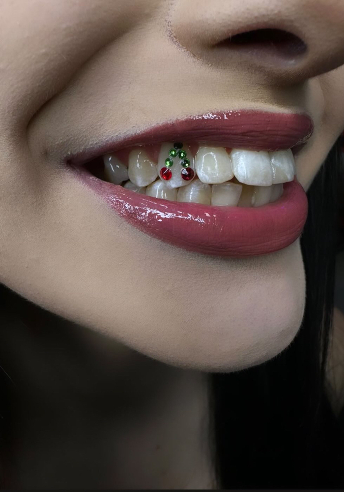 Cherry Design Tooth Gem