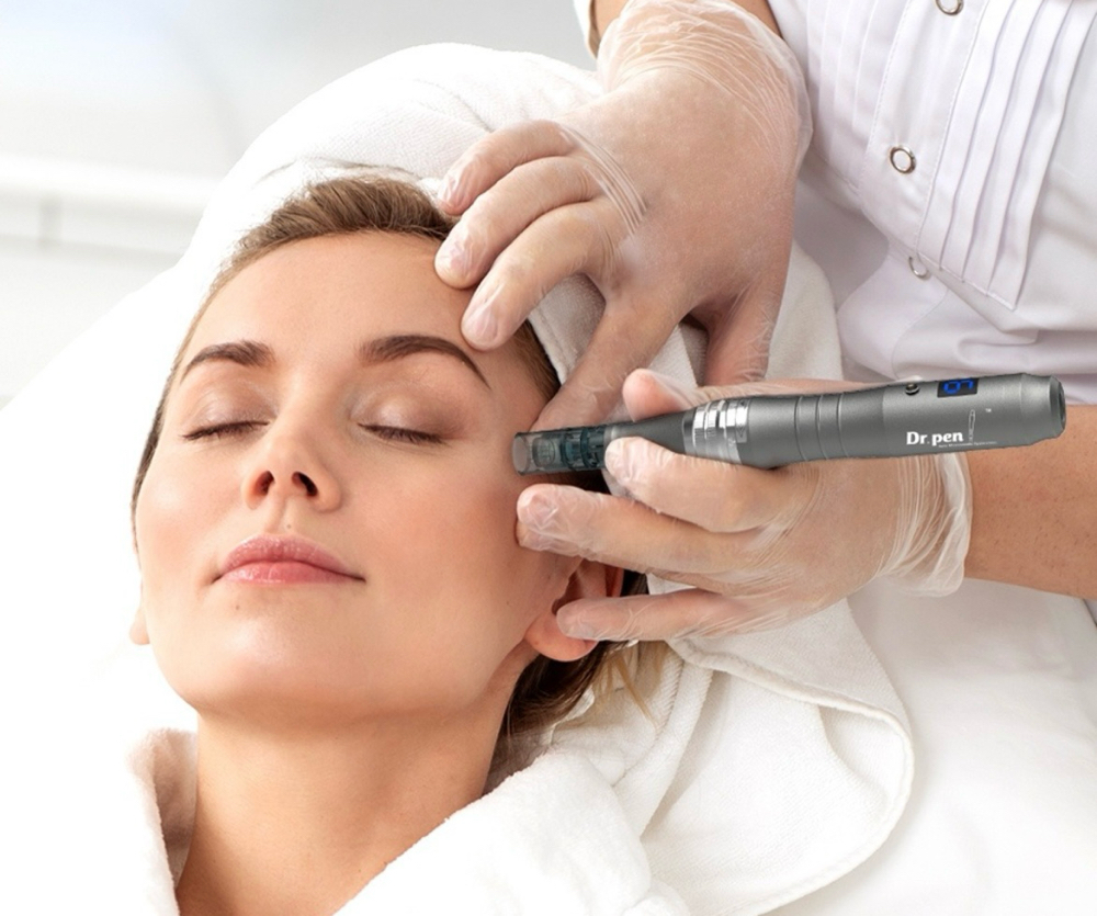 Microneedling Treatment