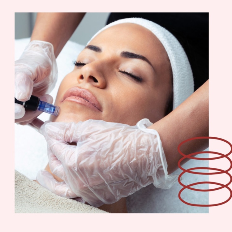 💧 Alma Glow Ritual (Microneedling) at Alma Latina Holistic Beauty in Fort Worth, TX