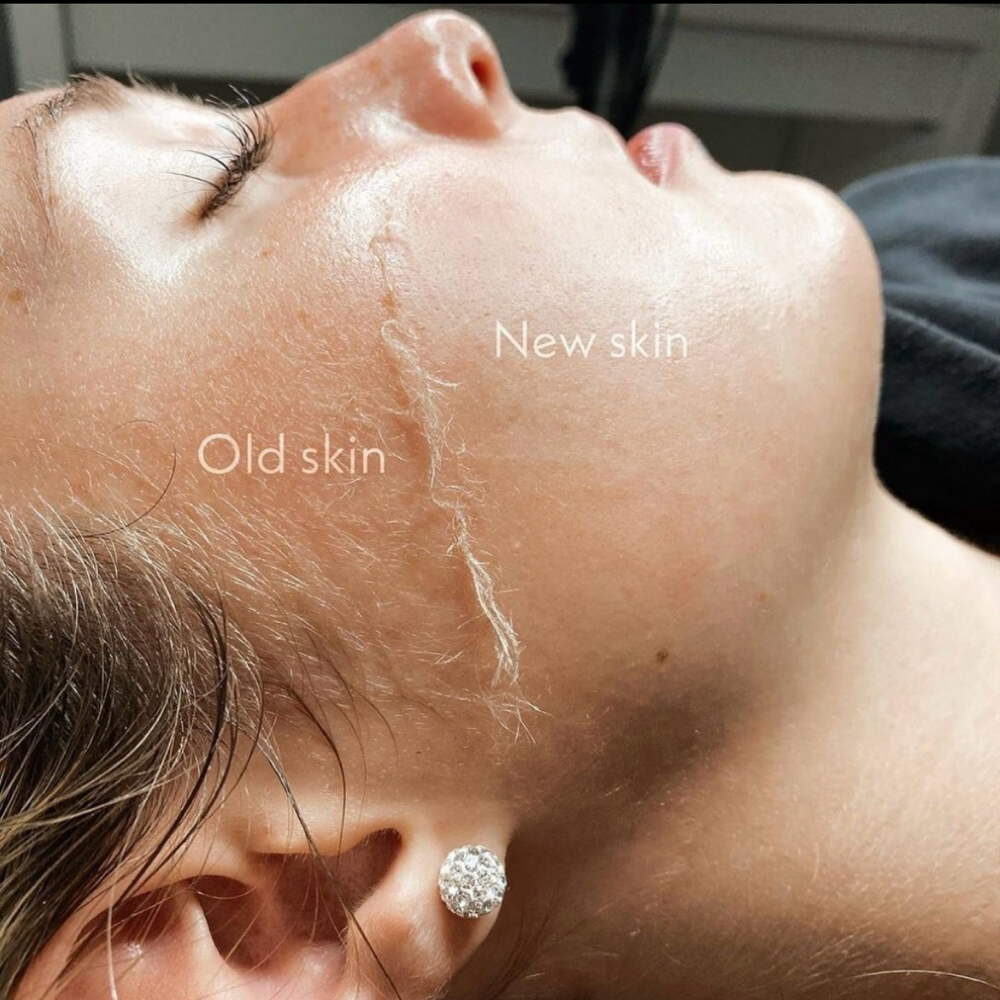 Dermaplane Facial at Glow Beauty Lounge in New Concord, OH