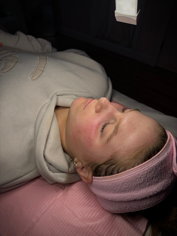Teenage Dream Facial