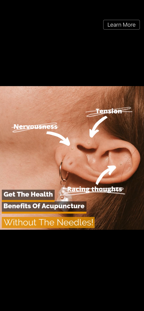 Ear Seeds