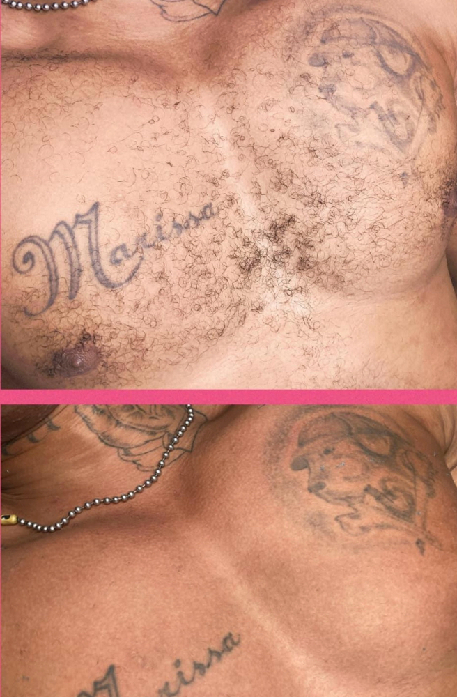 Chest Wax
