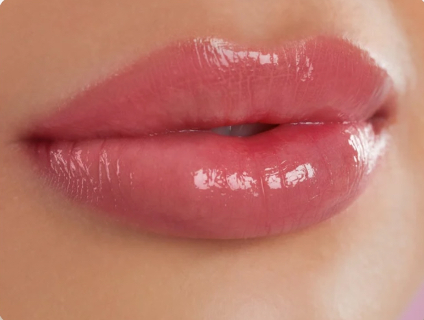 Lip Augmentation