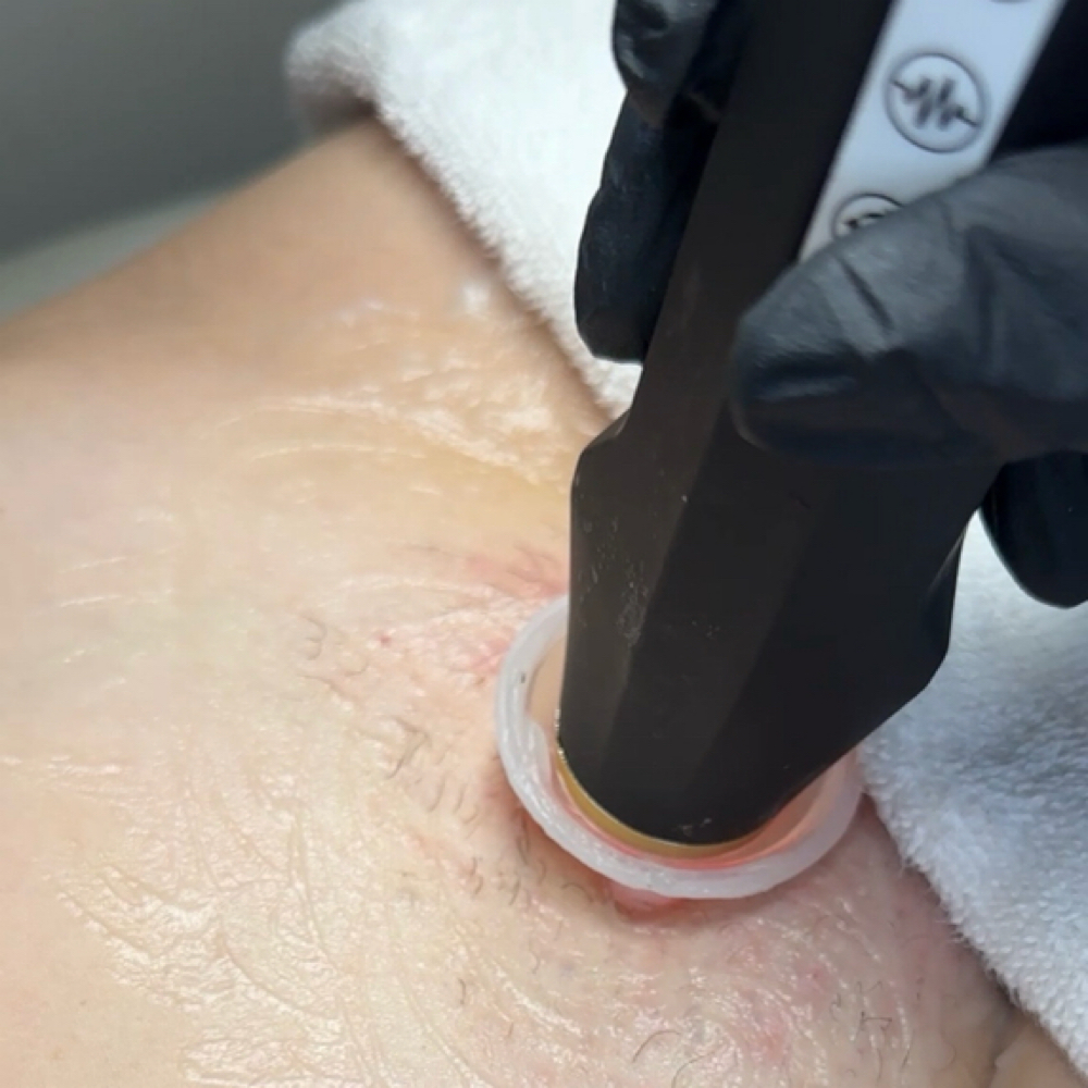 Transformative Oxy Glow Vajacial at curatedbeautybycaro in San Diego, CA