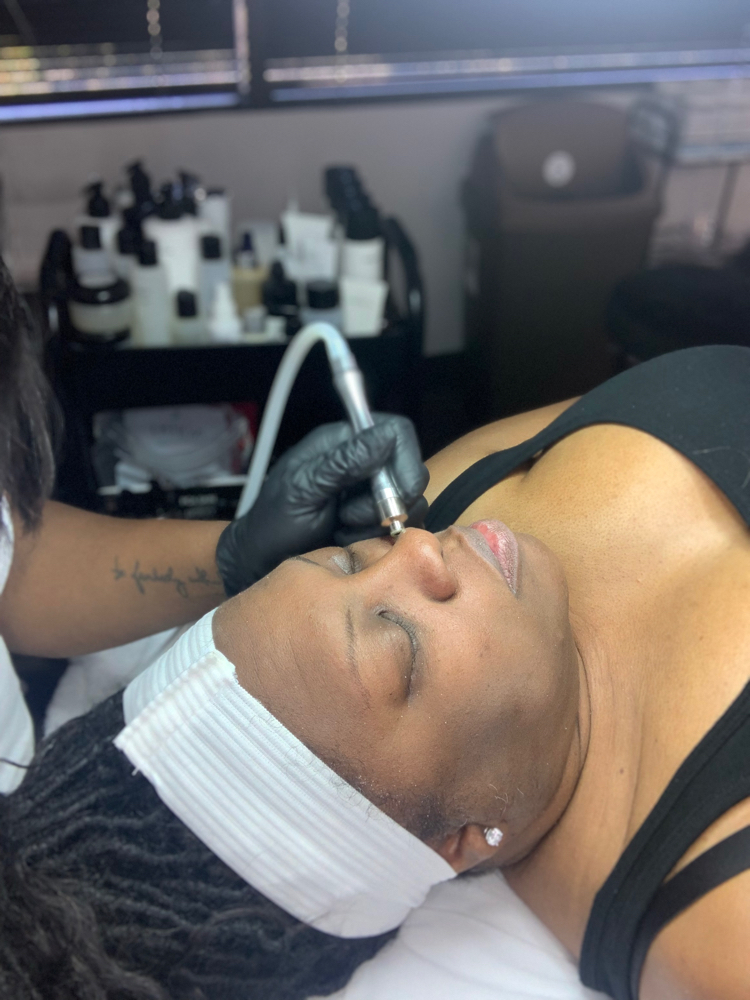 Microdermabrasion
