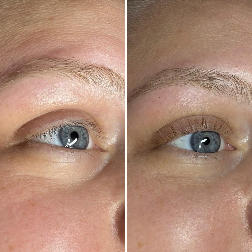 Lash Lift