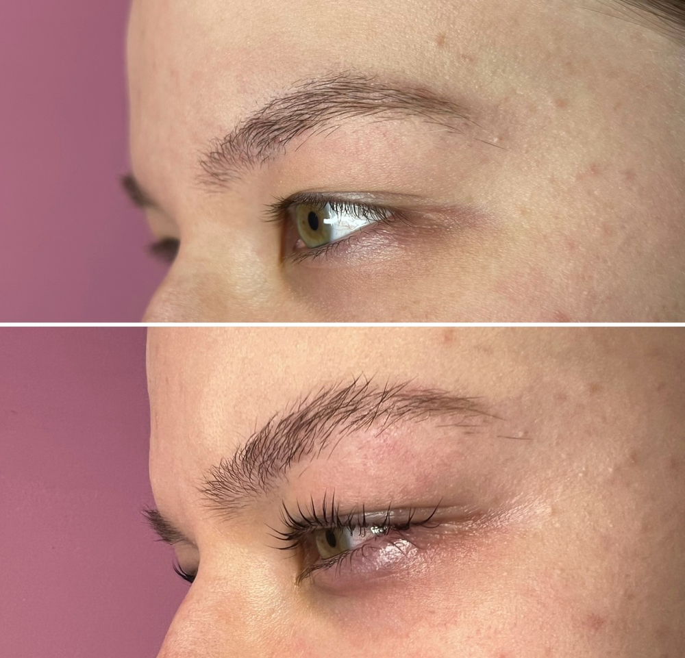 Lash Lift
