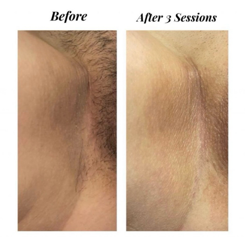 ✨Glow Kitty Intimate Bleaching ✨ at Nena’s Beauty Glow Bar in North Las Vegas, NV