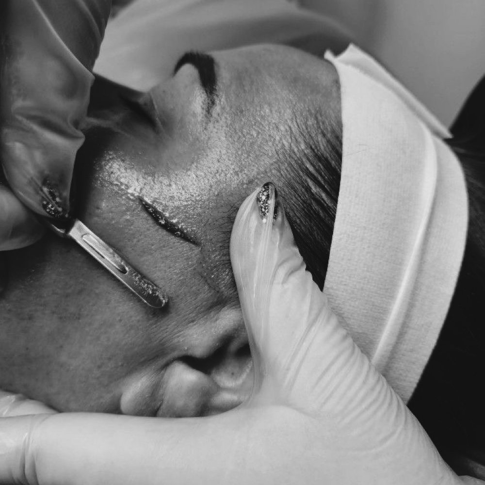 Dermaplane Add On at Summer Time Skin in West Plains, MO