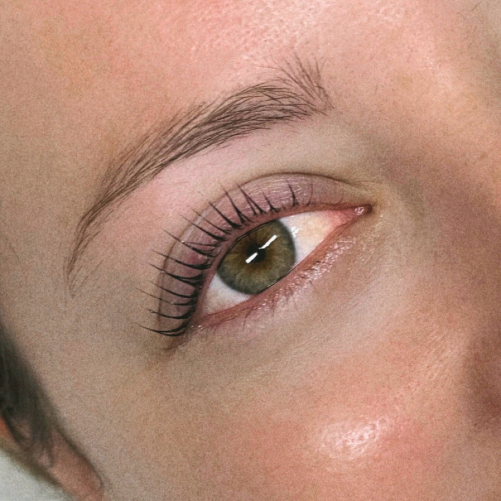 Loyal Beauty K-Lift at Little Beauty Clinic in Bonita, CA