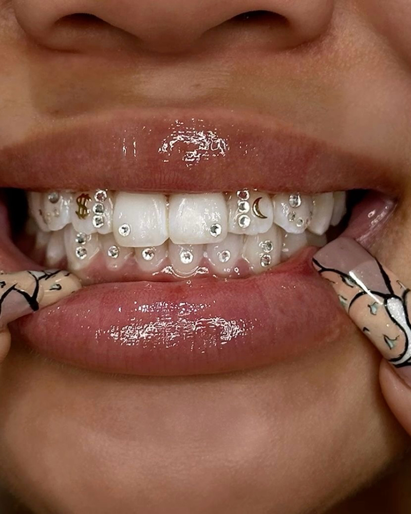 CUSTOM Tooth Gems