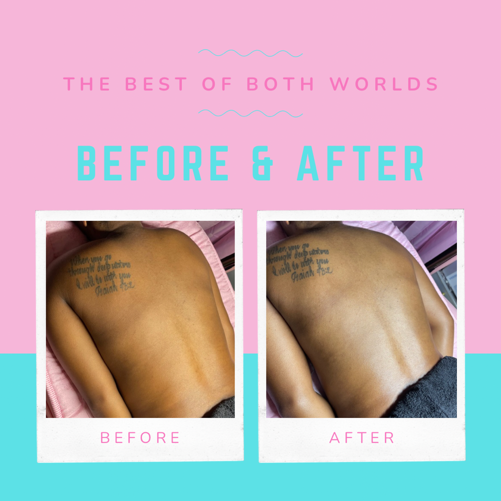 Back Facial