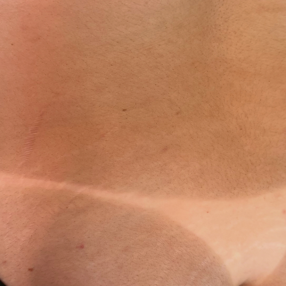 Hydrating Custom Spray Tan at The Queen of Spray Tans in Walland, TN