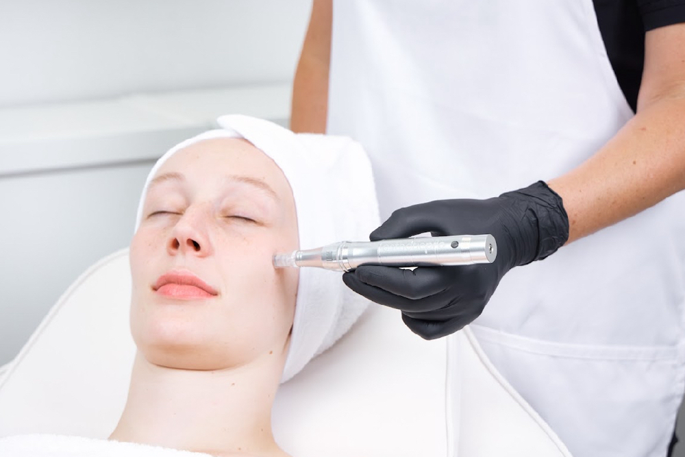 Nano Needling Glow Facial