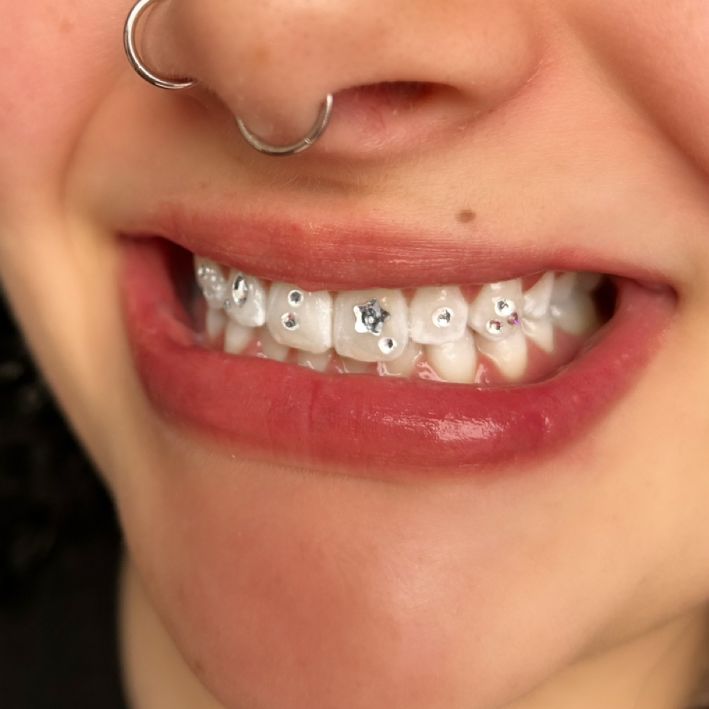 Tooth Gems Freestyle Set at Hailey Kay Hair in Minneapolis, MN