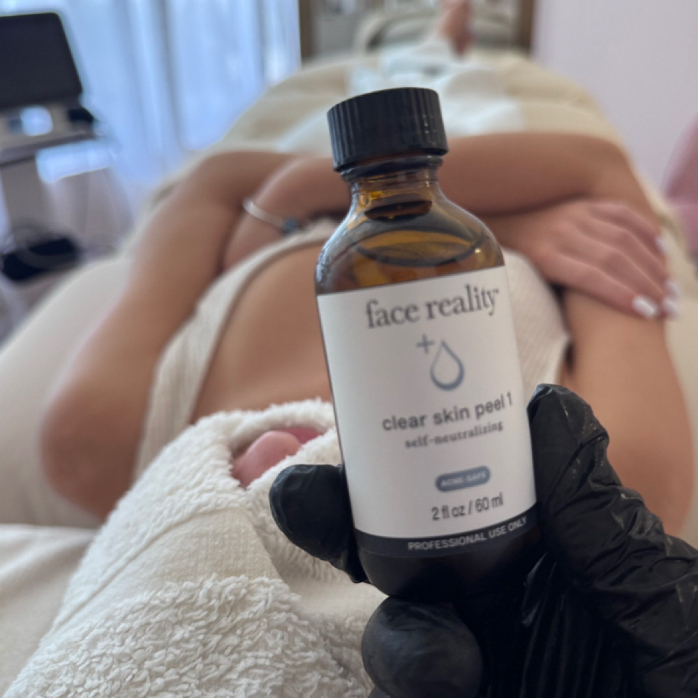 Face Reality Enzyme Treatment at Skyn Esthetics INC. in Boca Raton, FL