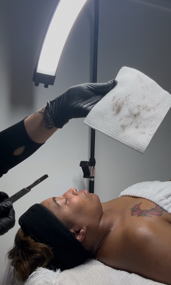 Dermaplane Facial