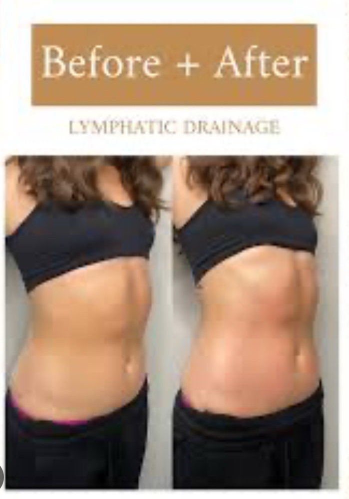 Lymphatic Drainage