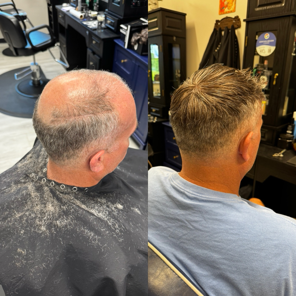 Toupee/Hair Replacement Consult