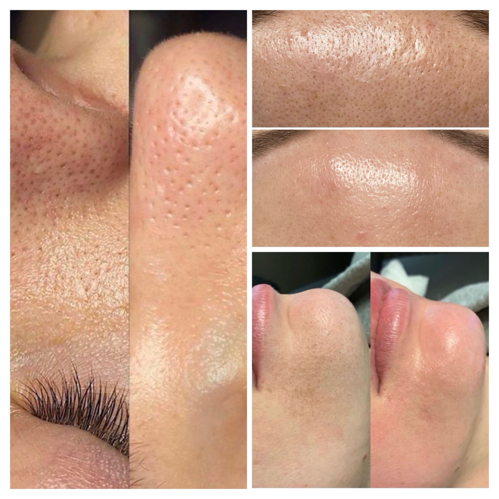 Soft Girl Summer Facial âď¸ at Sigh Beauty Bar in Merritt Island, FL