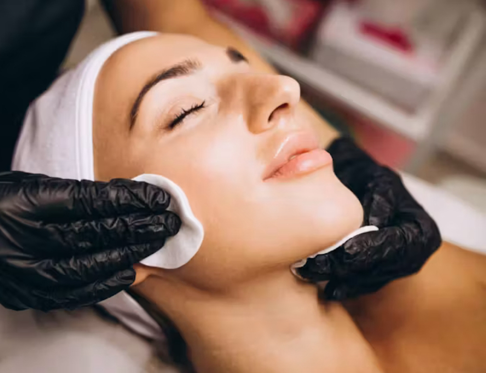 Chemical Peel