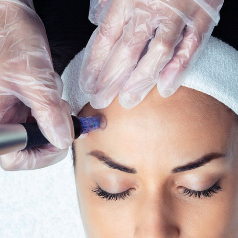 Nano ADD ON at DuoGlo Esthetics in Fredericksburg, VA