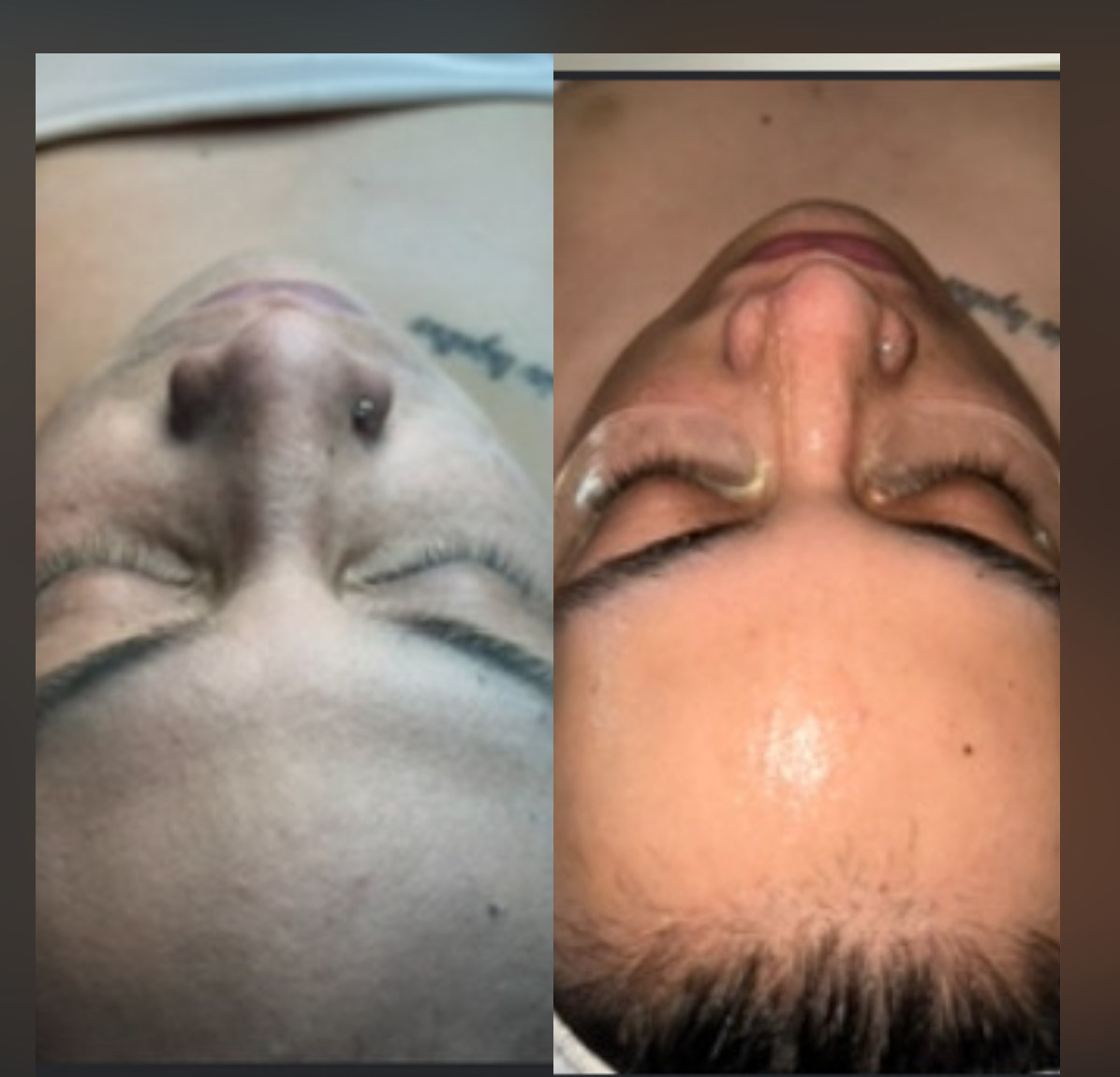 Basic Facial