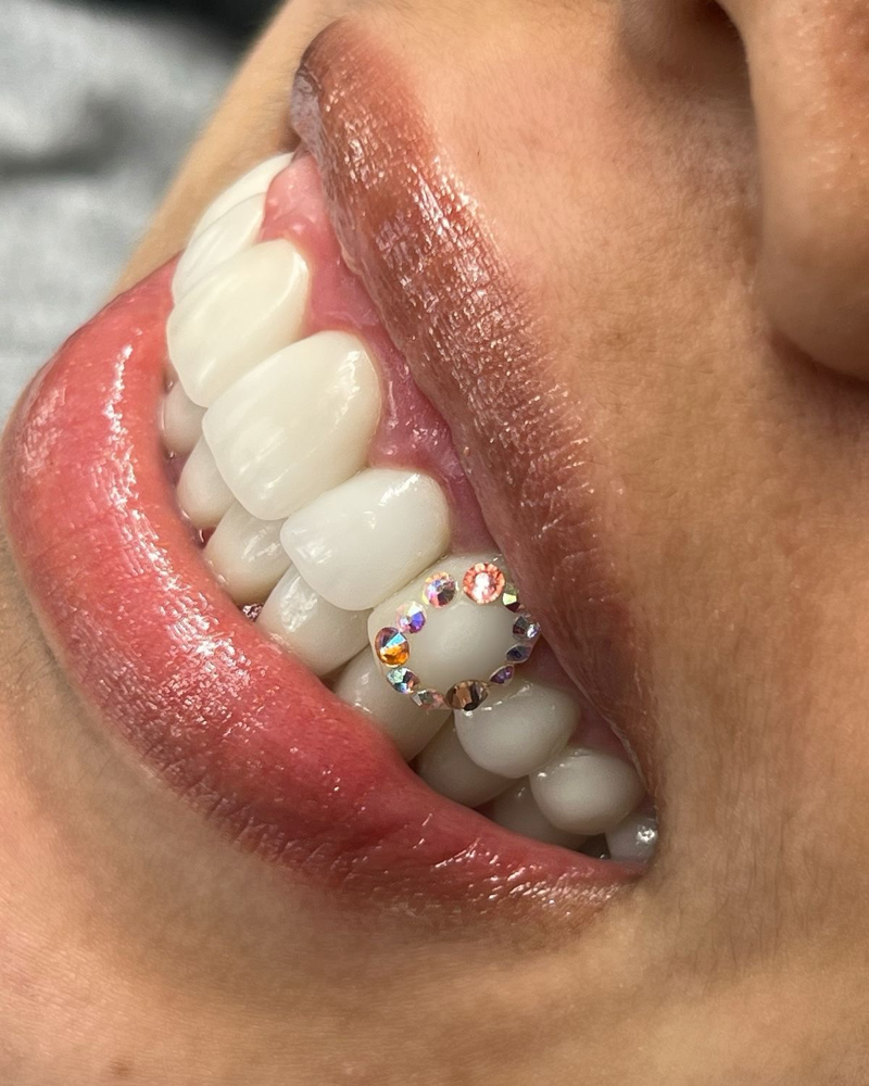4 TOOTH GEM TRIM