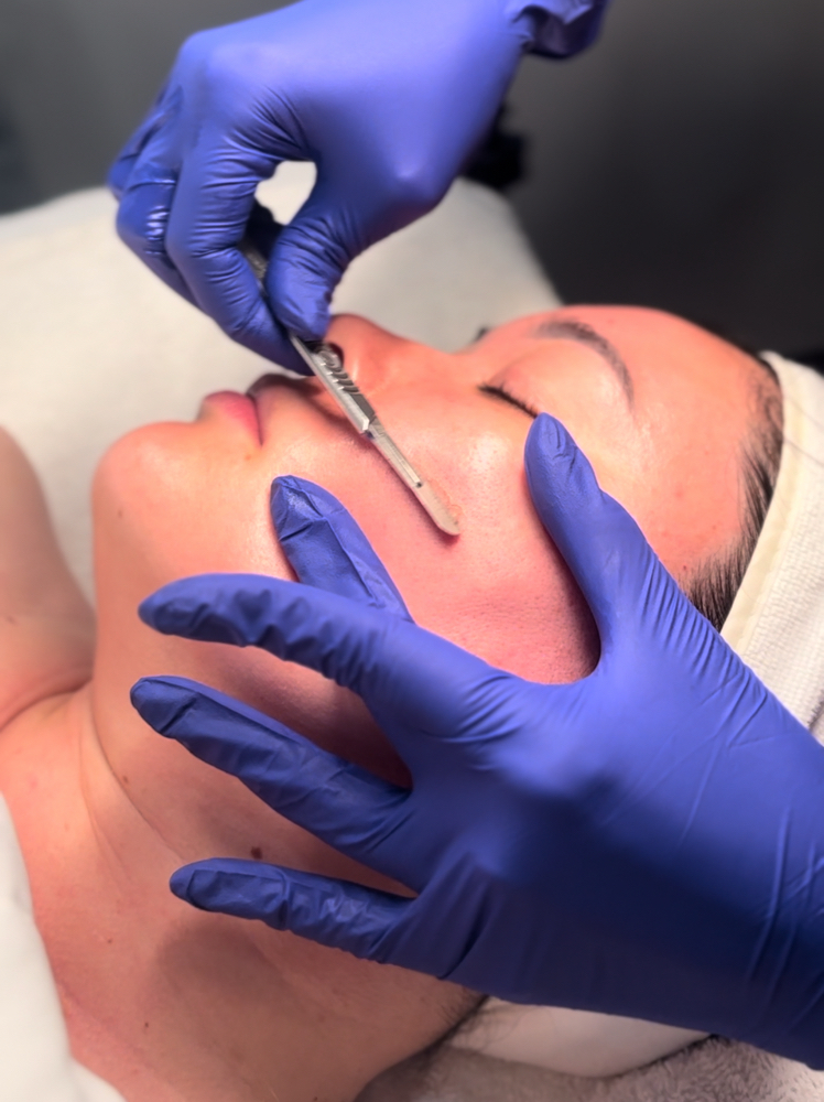 Dermaplaning Add On