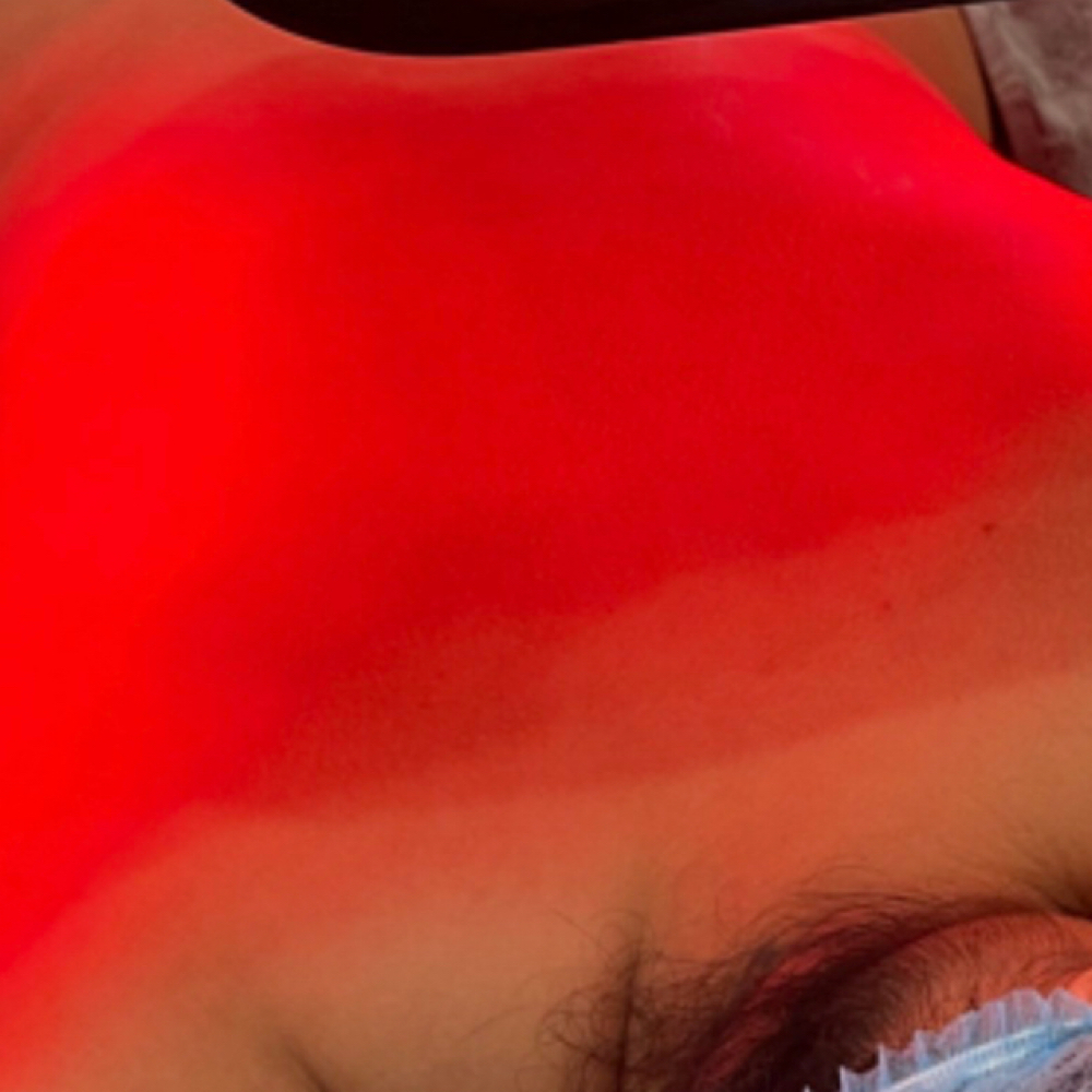 Back Glow Therapy + LED Celluma at MG Beauty Studio & Aesthetics in Johnston, RI