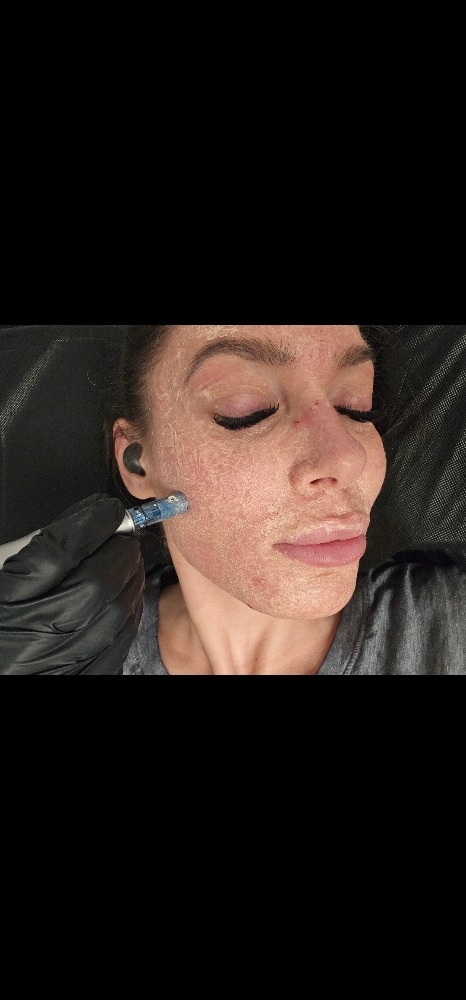 The Veil - Similar to a BB Glow