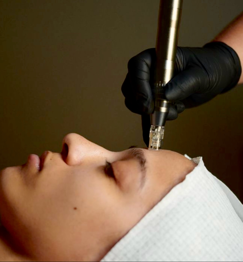 Nano Facial With Stem Cells