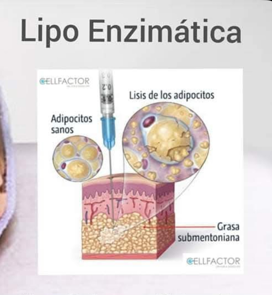 lipo shots FACE 4 SESSION