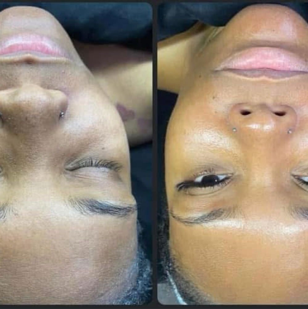 Oxygen Facial at Asia’s Oasis in Syracuse NY, NY