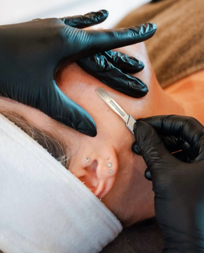 Dermaplaning at Pure Aura in Higginsville, MO