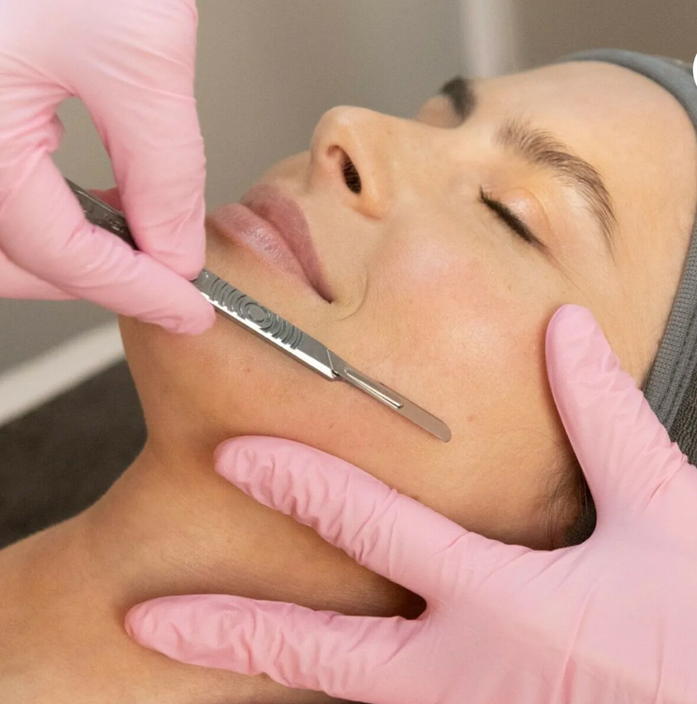 Add On Dermaplaning at Radiant Skin by Christine in Abilene, TX