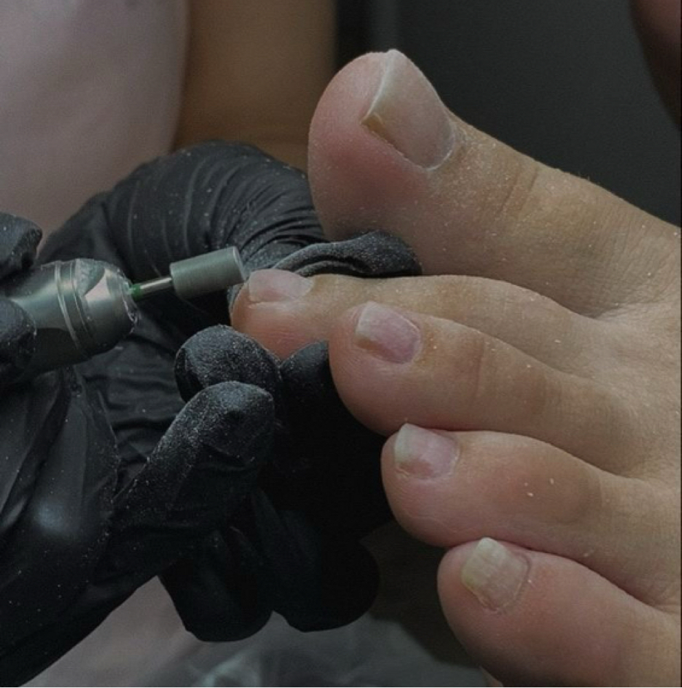 Sculpted Toe Set Removal at Itz_JAMC Nails in Webster, TX