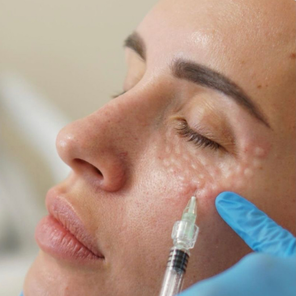 Korean Undereye Treatment at NATURAL CARE DOC - Holistic Medspa in Phoenix, AZ
