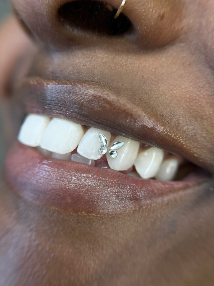 Simple Tooth Gem Design