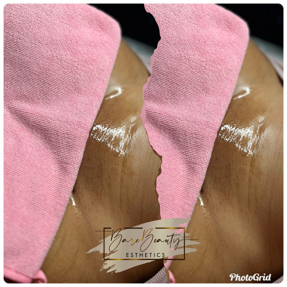 Returning Beauty Brazilian 6-8 Wks