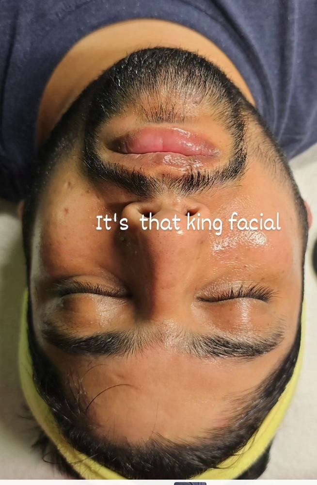 King Facial