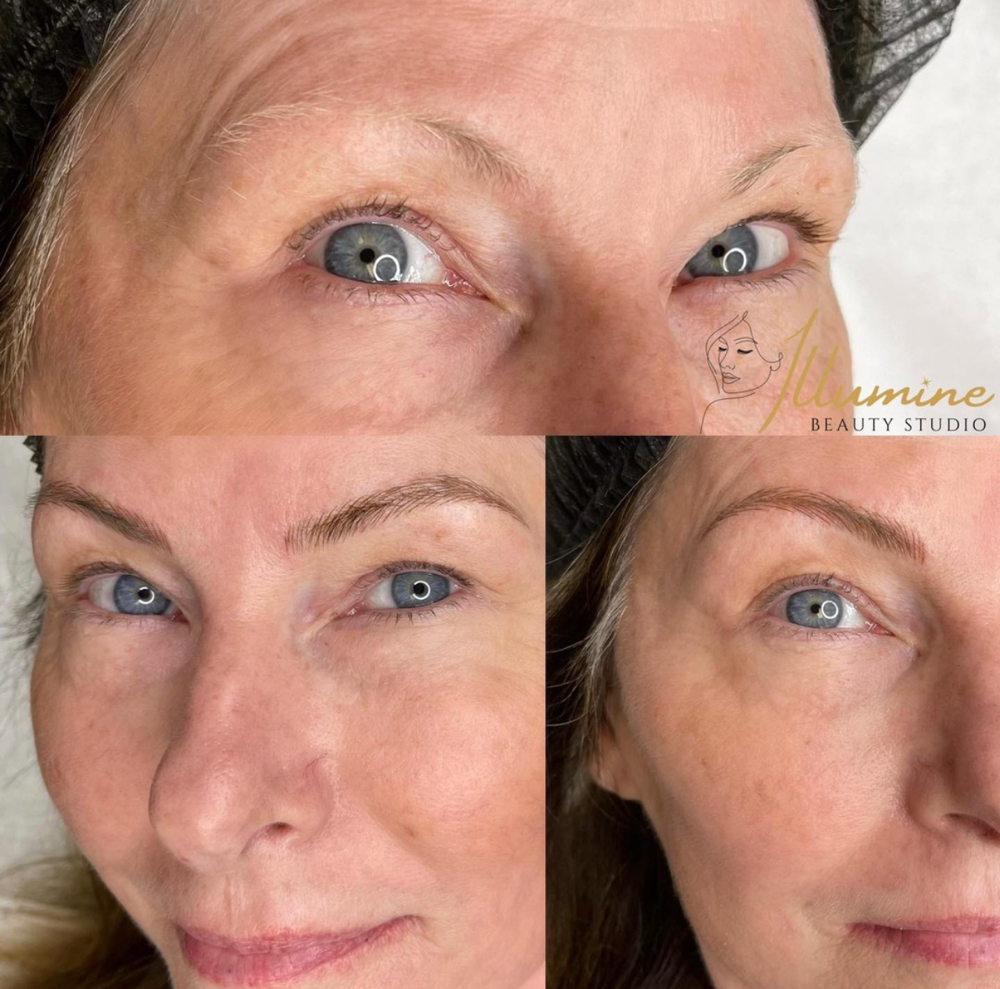 Realistic Nanoblading Eyebrows
