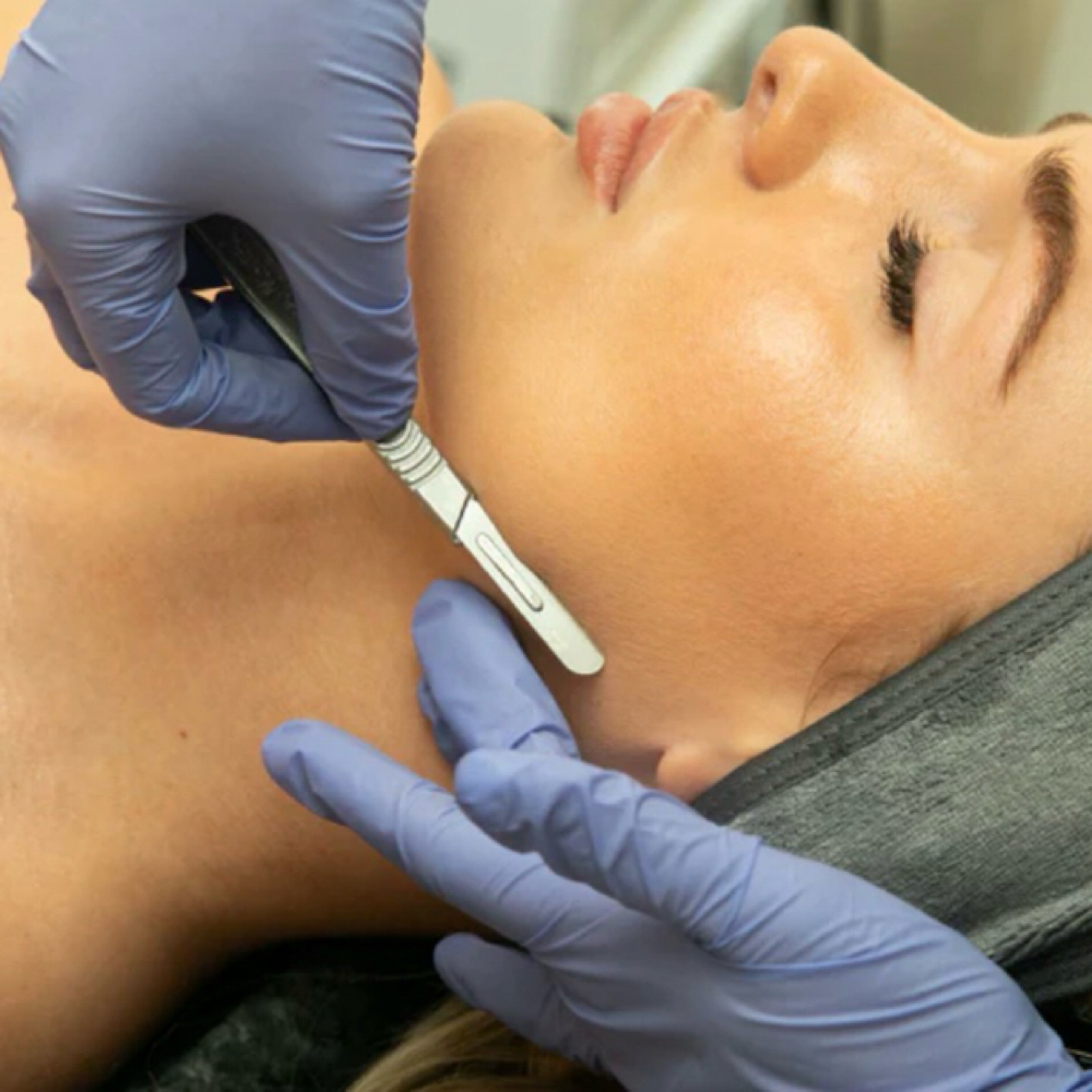 Dermaplane at D’Aura Esthetics in Salem, OR