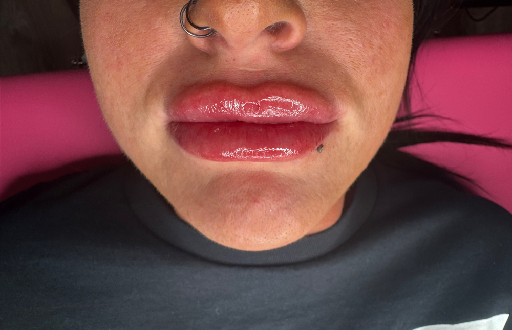 2 ML