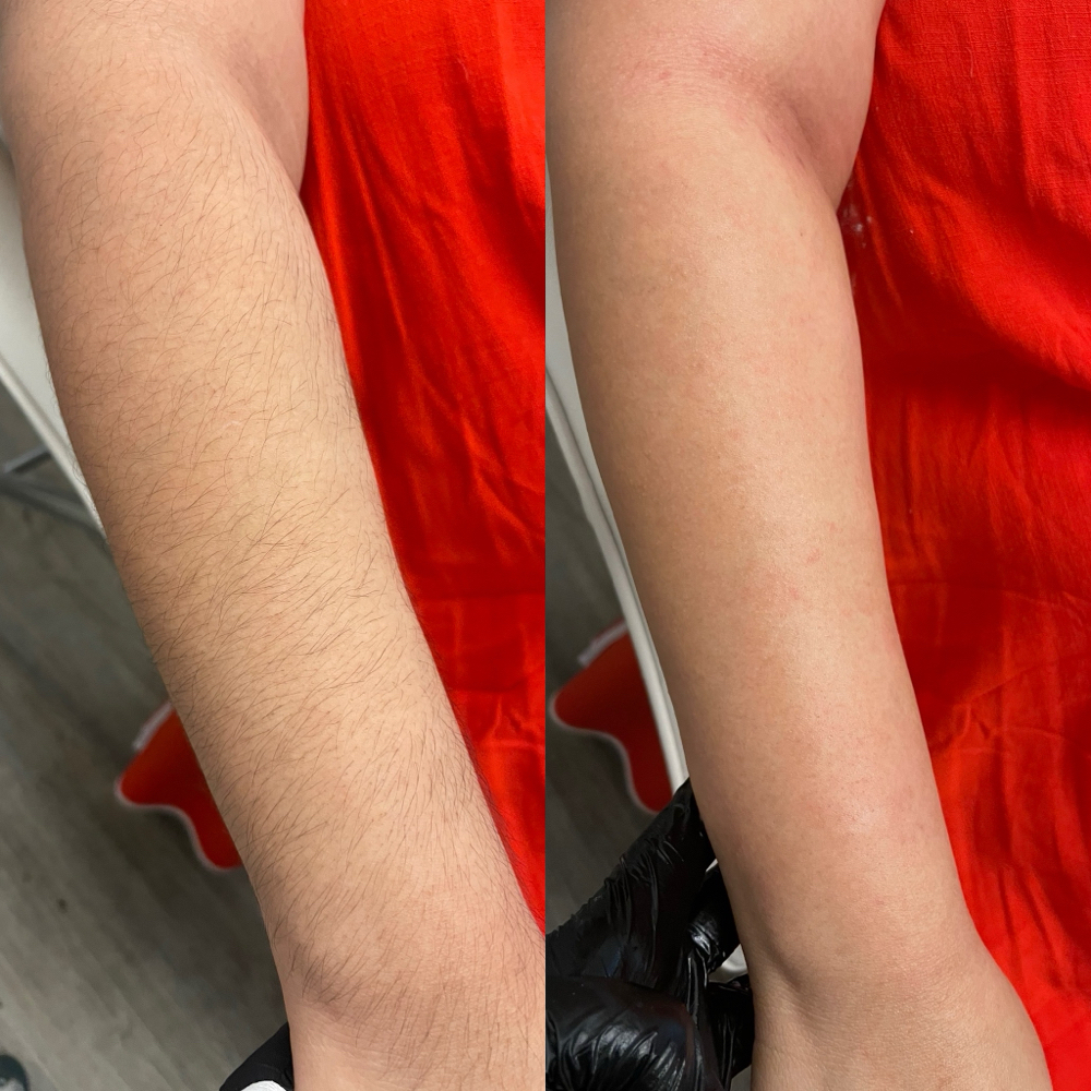 Half Arm Wax at De Colores Beauty Bar in Chicago, IL